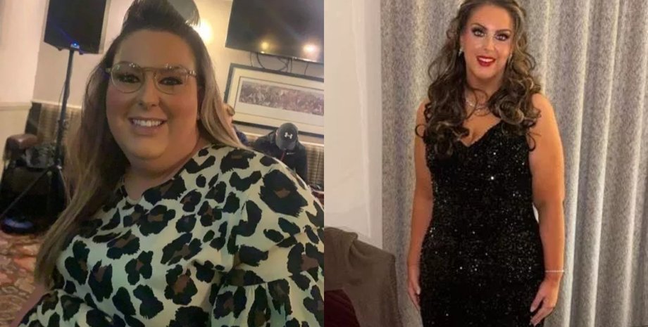 Женщина похудела на 70 кг, лишний вес, операция, бандажирование желудка, резкое похудение, фото до и после, диета,