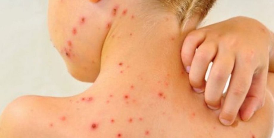 Иллюстративное фото