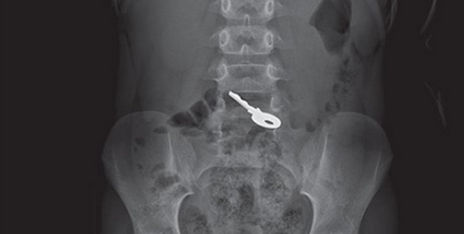 Мать обратилась к врачам только на следующий день