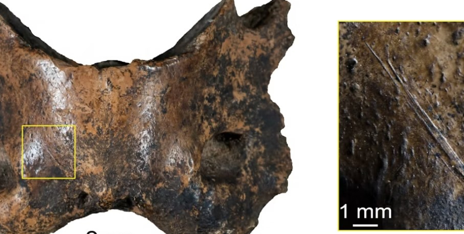 кости кости