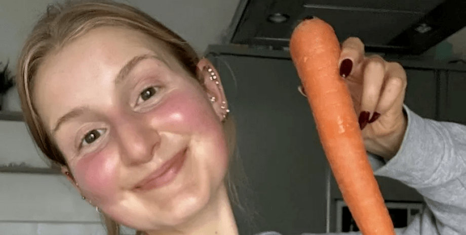 Жінка з'їдає багато моркви, цілий день їла моркву, шкіра оранжевого кольору, корисно для здоров'я, кератин, Умпа-Лумпа