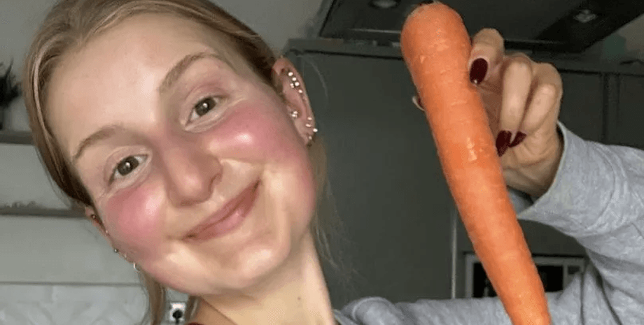 Женщина съедает много моркови, целый день ела морковь, кожа оранжевого цвета, полезно для здоровья, кератин, Умпа-Лумпа