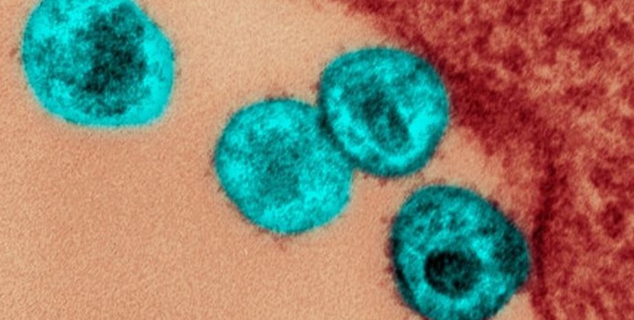 вич, лечение вич