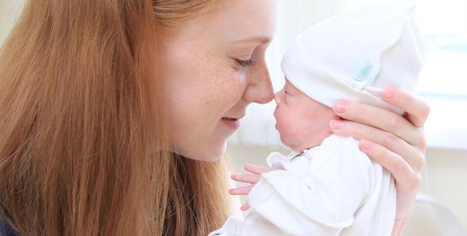 Аномальные волосы, внешность, дети, малыши, генетика, странная шевелюра, курьезы, интересности