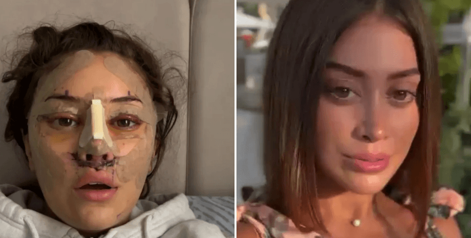 Эмили сделала подтяжку Эмили сделала подтяжку