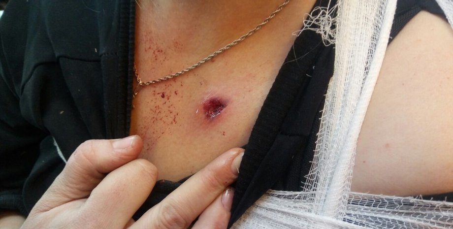 Фото: пресс-центр штаба ООС