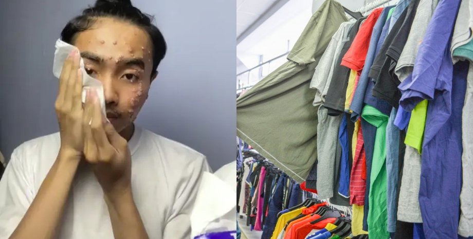 Инфекция, одежда, секонд-хенд, решил сэкономить, одежда из секонд-хенда, стирка одежды, отбеливатель, кожная болезнь,