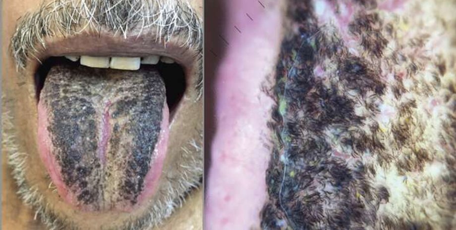 язик, чоловік, волосся, фото