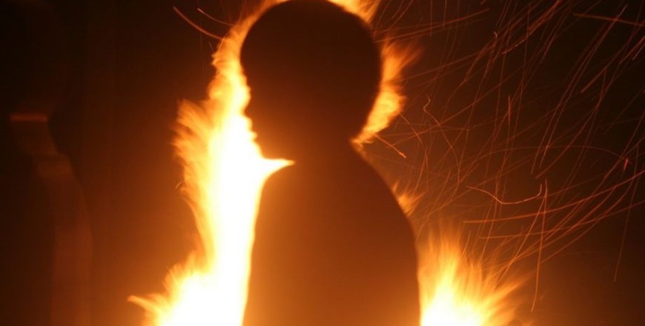 поджог, ребенок, ожоги