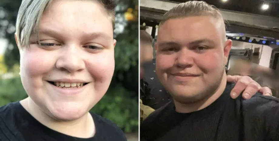 Парень с внешностью и голосом женщины, Эшли Хемминг из Вустера, тестостерон, борьба с гипогонадизмом, диагнозы, расстройства