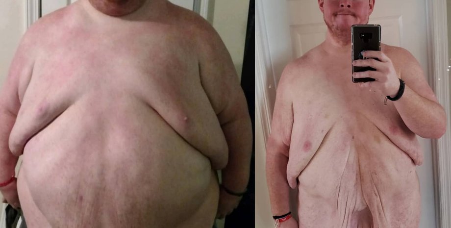 Кеудедегі ашық порно видеолар