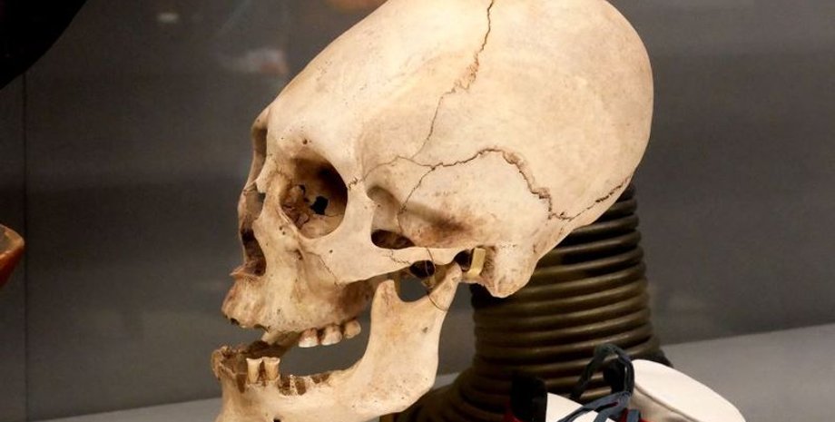 череп, деформация, младенец, последствия, форма, память, город, культура, традиция, техника, доска, воин