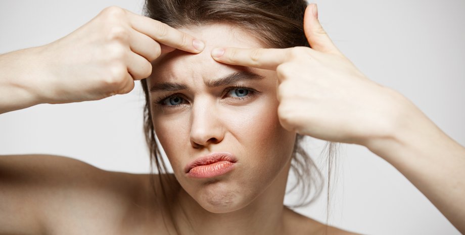 Избавиться от прыщей народными средствами