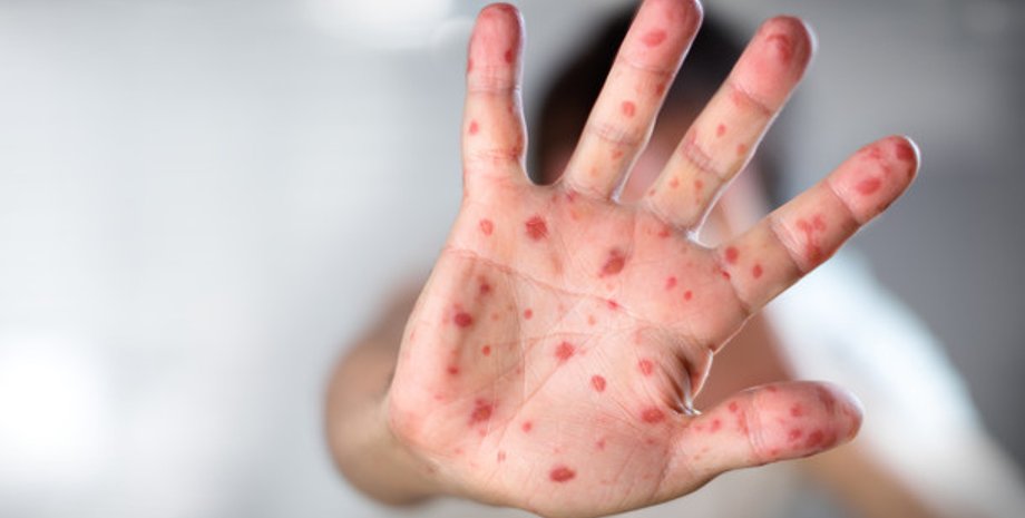 Фото: antikor.zp.ua