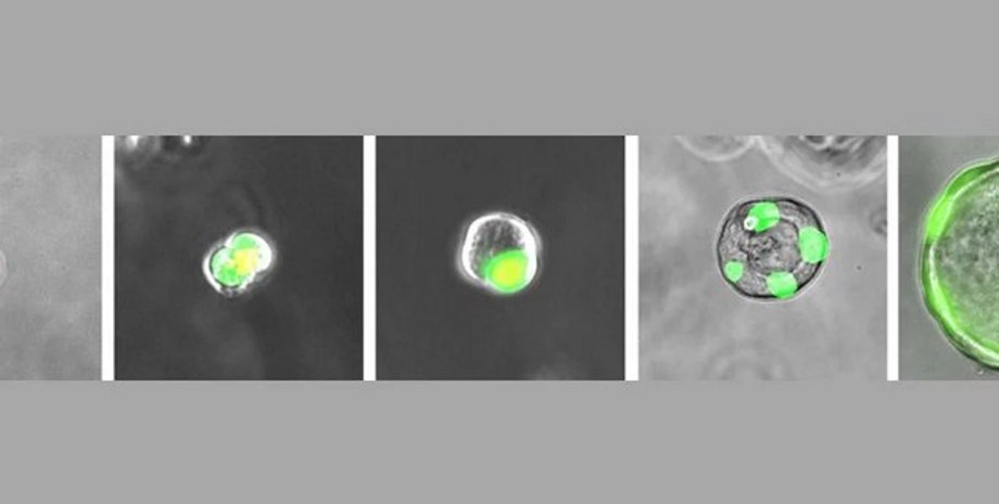 Клетки RAS, легкие человека