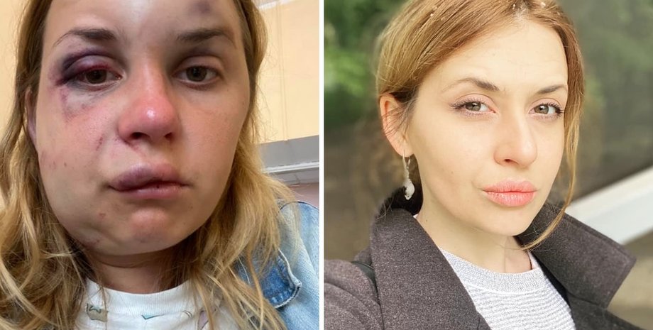 Фото: Facebook Анастасия Луговая