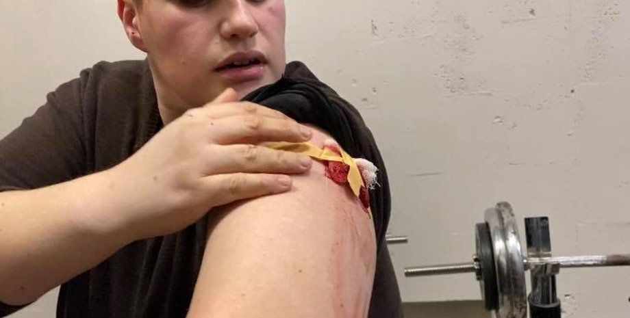 Потерпевший в стрельбе/Фото: facebook.com/Tyshchenko.Volodymyr