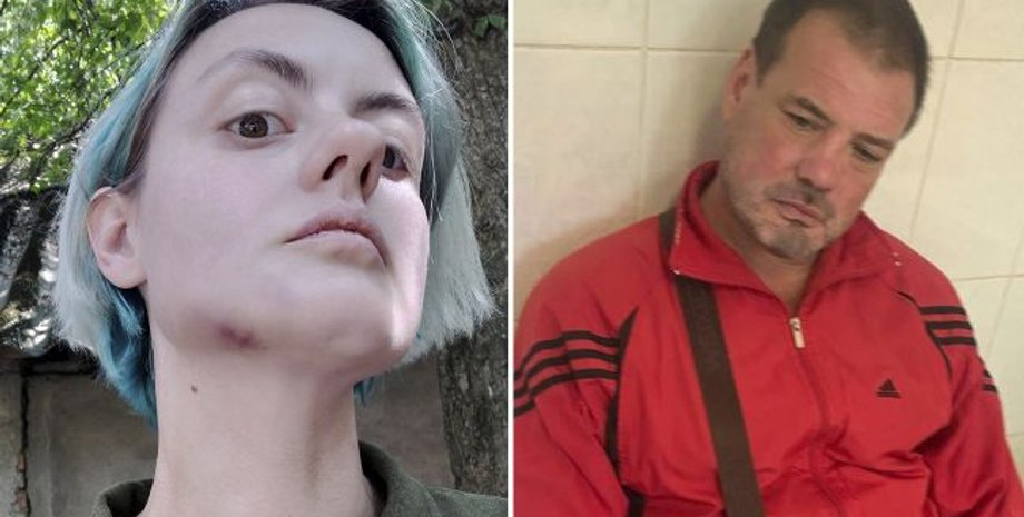 новини закарпаття, новини ужгорода, військком, побиття, військовослужбовець, військкомат