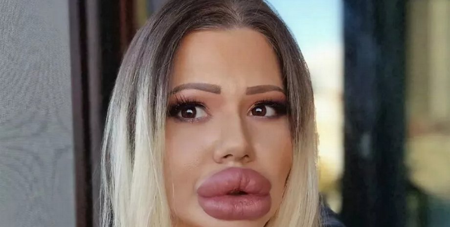 У разі ускладнень існує ризик відмирання тканин