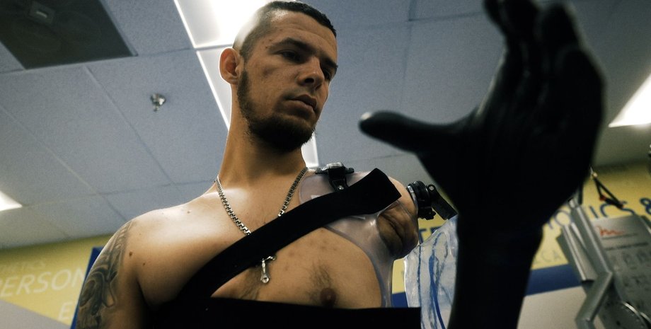 Військовослужбовець Георгій з рукою з вуглецевого волокна