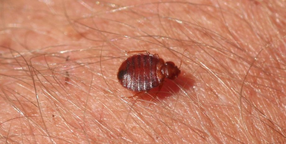 постільна клоп, шкіра, волосся, фото