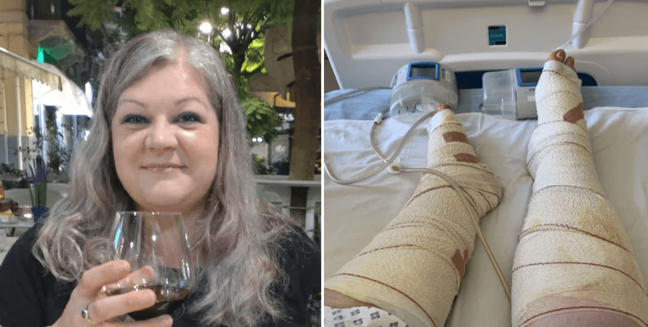 Укус паука ядовитые пауки