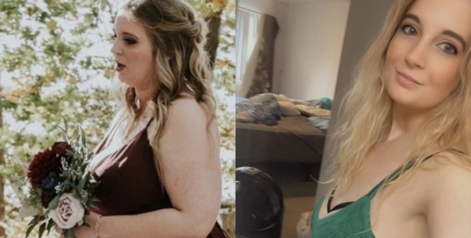 Жінка скинула вагу, рідкісний діагноз, рідкісна хвороба, дізналася через Facebook, випадкове відео змінило життя, страждала від сильного болю