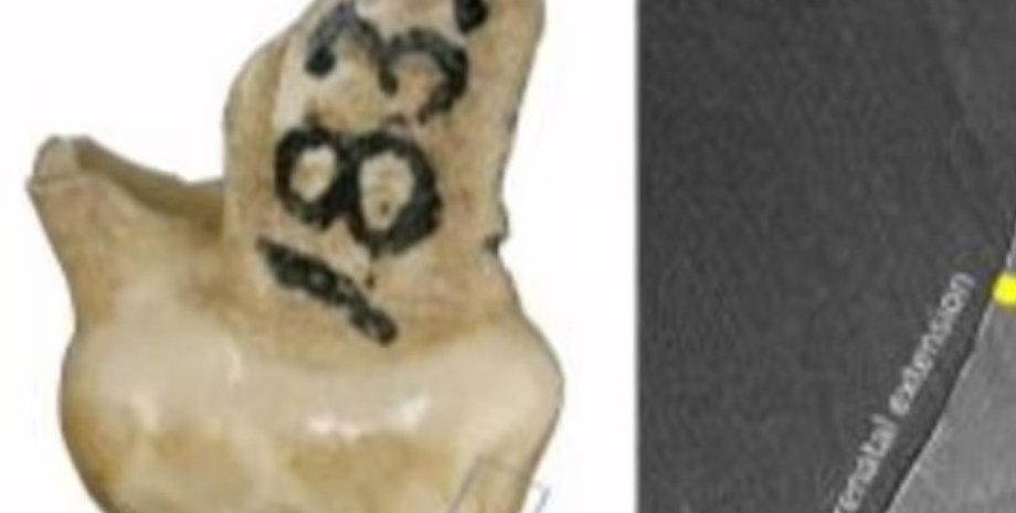 зуб, ребенок, неандерталец