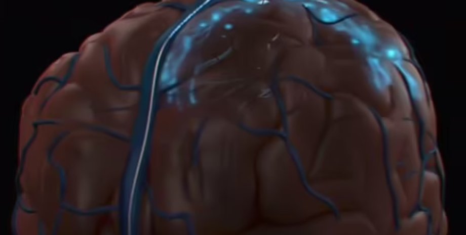 мозок, воскресити мозок, повернути мозок до життя