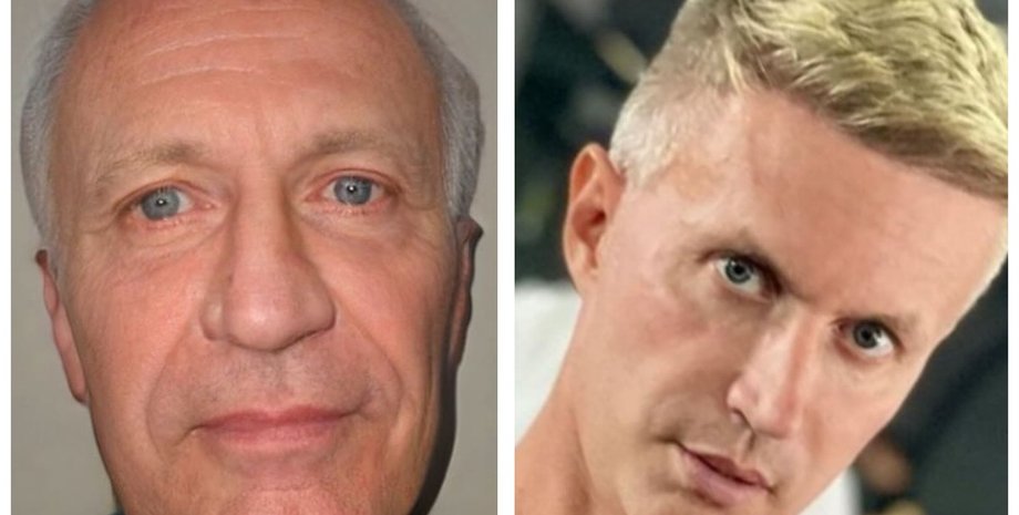 пластика обличчя, омолодження