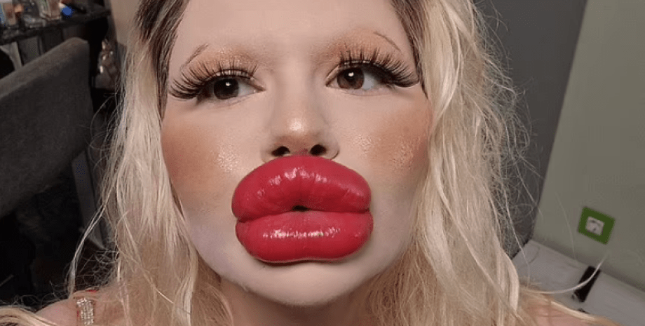 Андреа Иванова из Болгарии, самые большие в мире губы. красота, внешность, косметические процедуры, трансформация, фото, курьезы