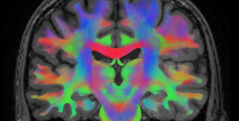 мозг, верующие, наука, атеизм