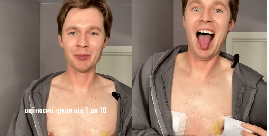 удаление груди у мужчин