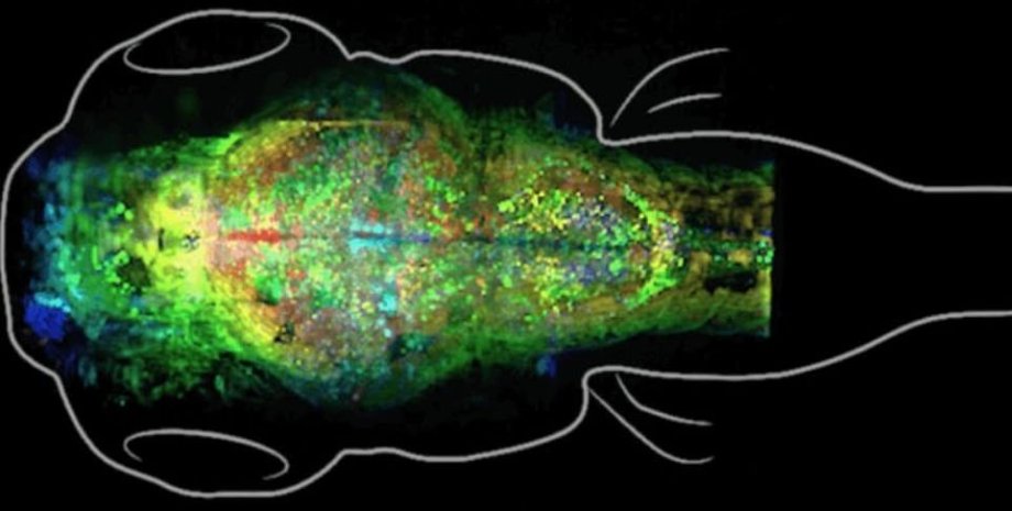 Мозок, "риби-зебри", під мікроскопом