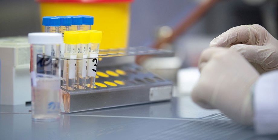 тесты на коронавирус, COVID-19, коронавирус в Украине