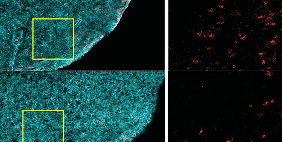 рак, CD8+ T-лимфоциты