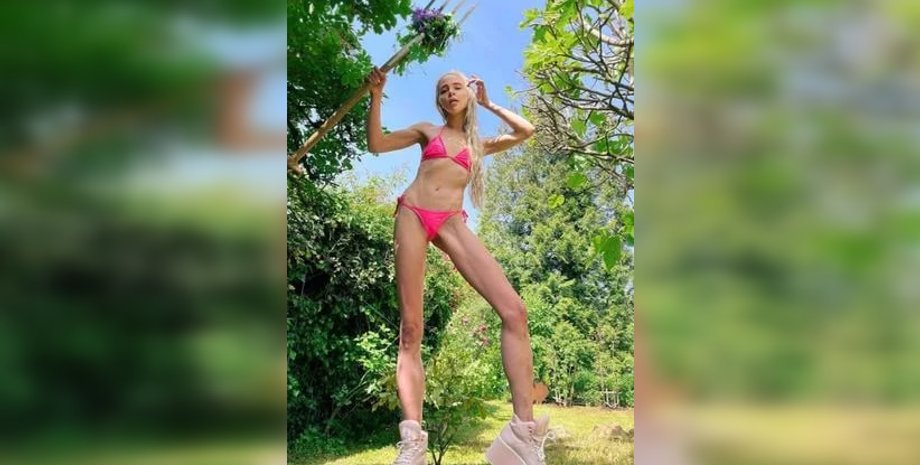 Модель, Терезия Фишер, удлинение ног