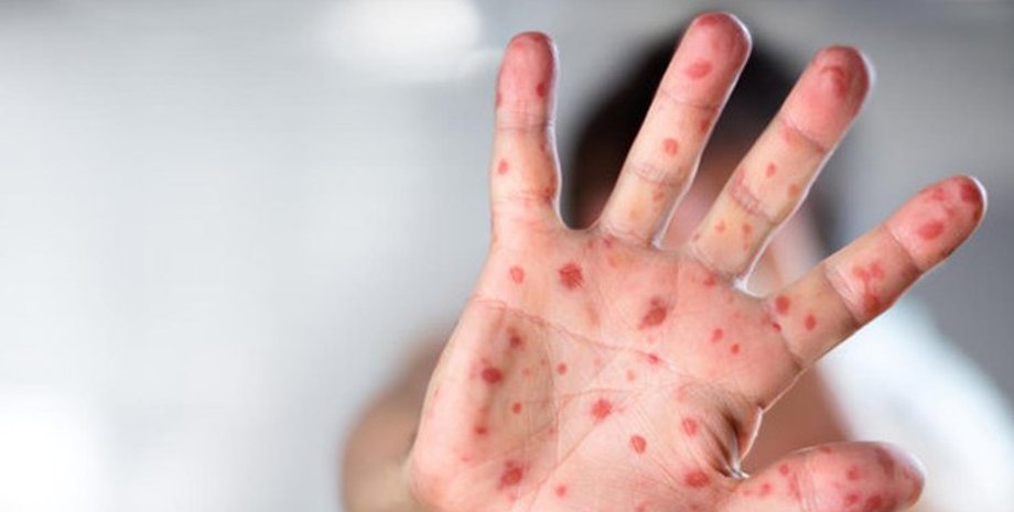 Фото: Podrobnosti