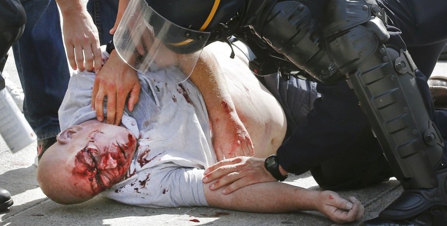 Избитый футбольный болельщик / Фото: Reuters