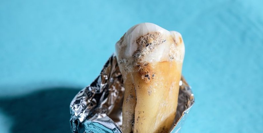 древняя ДНК, зубной налет, неандертальцы, микробиом, природная молекула, метагеномика, биосинтетический потенциал, утраченное микробное разнообразие, антибиотики, исследования, древние люди, генетика