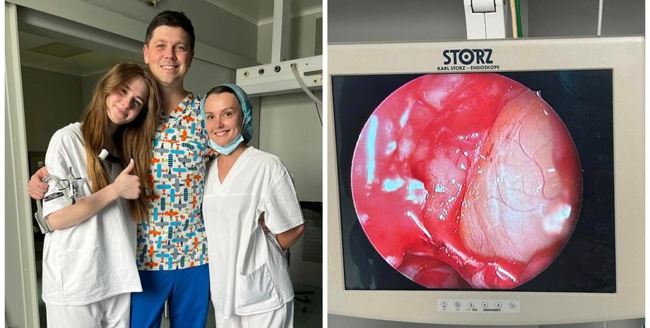 хирурги, операция, удаление полипа