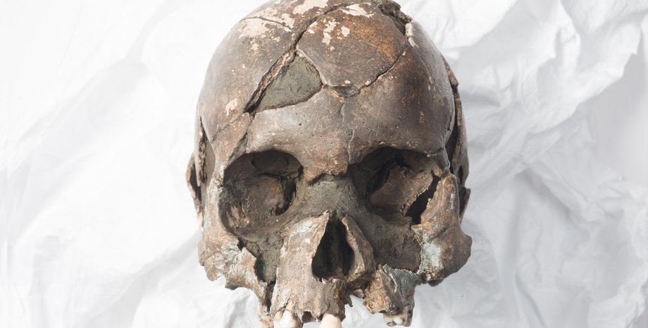 череп кости трещина