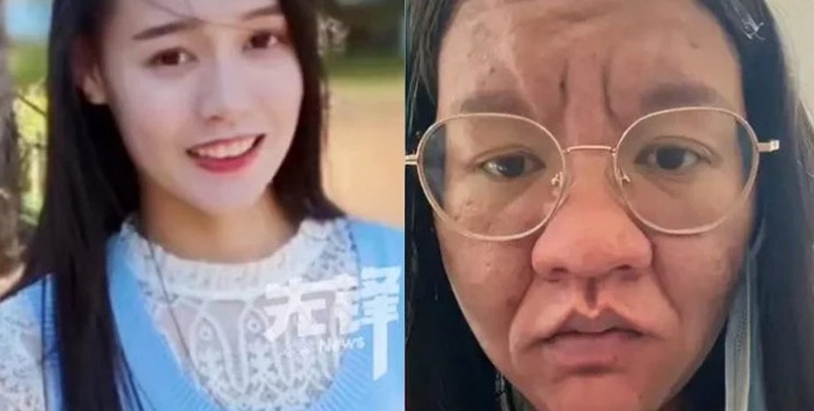 Молодая мама из Китая показала реальные фото до и после родов