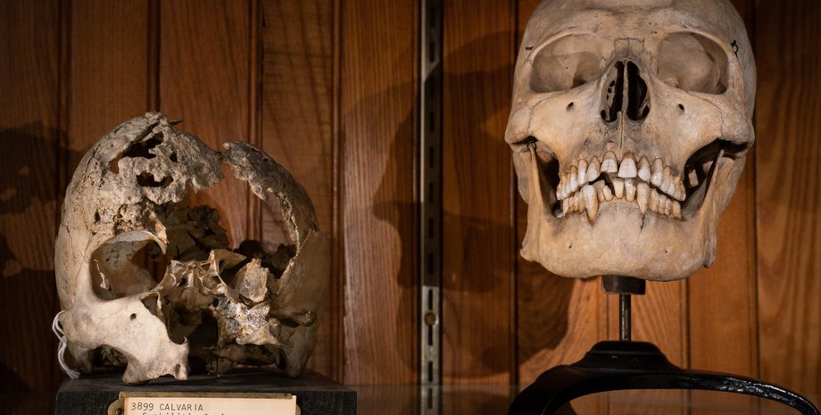 черепа, зубы, фото