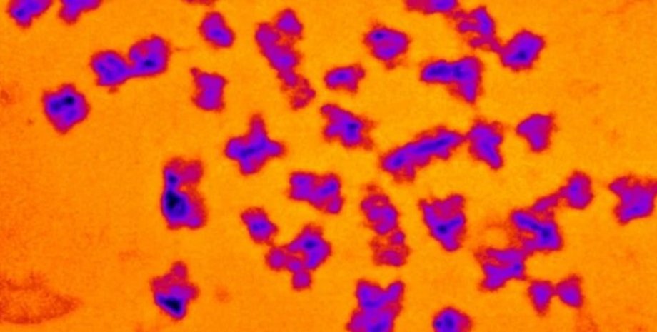 Рентгеновские снимки хромосом человека