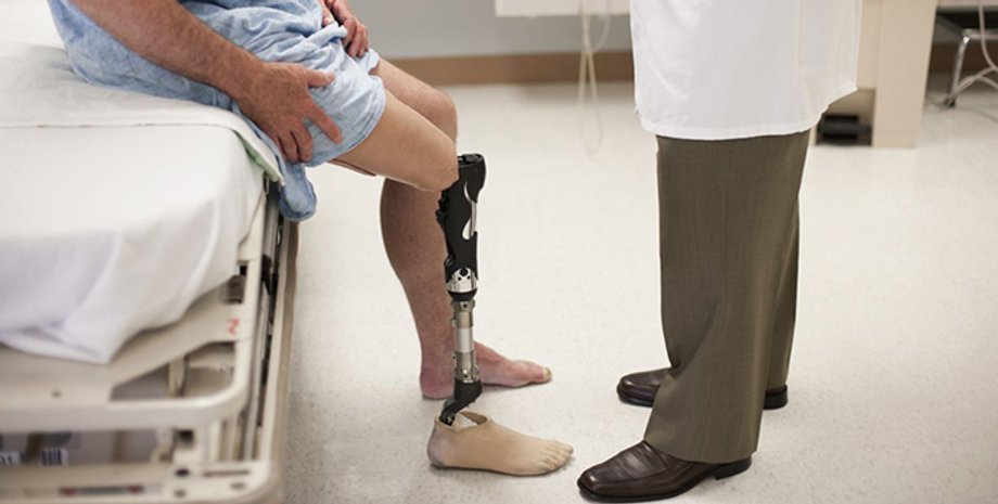 операция, ампутация