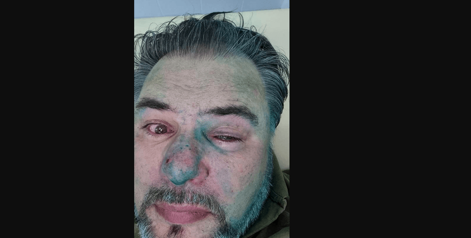 Коцаба, напад, зеленка, фото