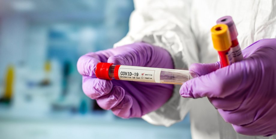 Китай та COVID-19, COVID-19 походження, COVID-19 розслідування, COVID-19 науковці, COVID-19 КНР, COVID-19 Ухань, COVID-19 США Китай, COVID-19 звіт