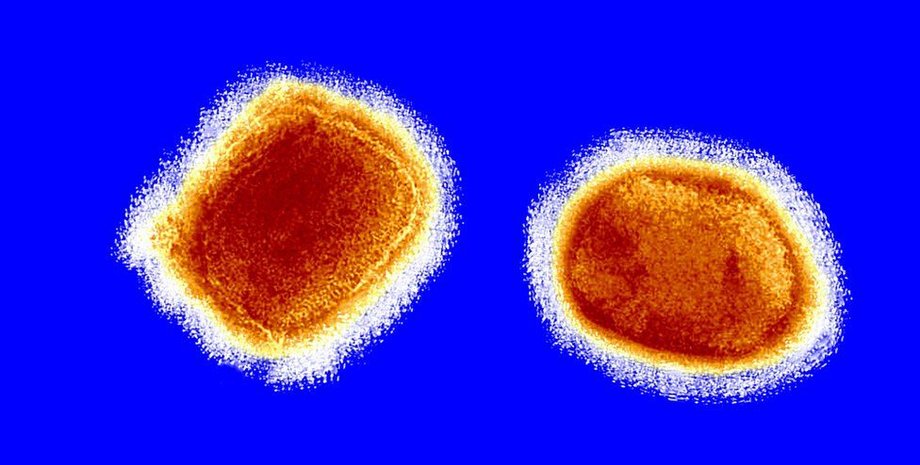 мавпа віспа, віспа мавп, вірус, захворювання, карантин, бельгія