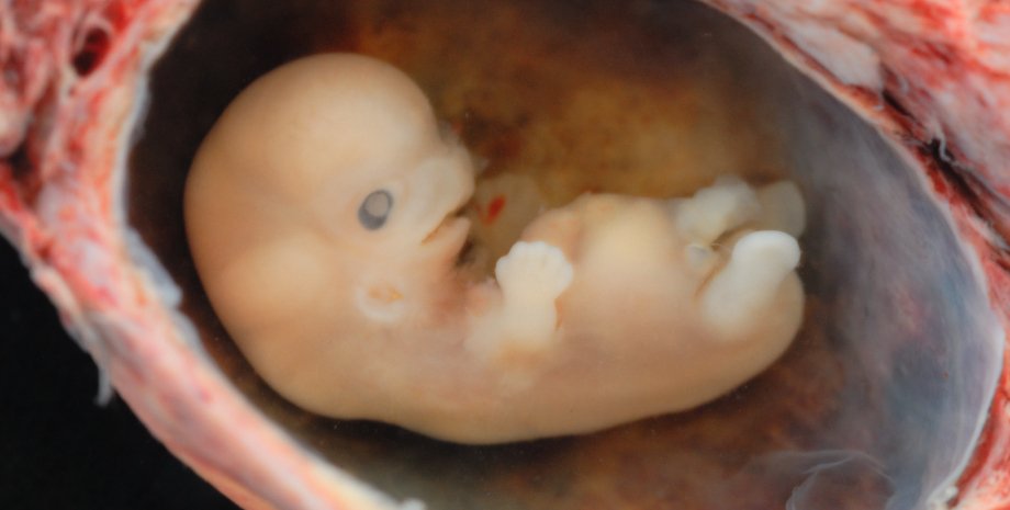 эмбрион, матка. жизнь, фото
